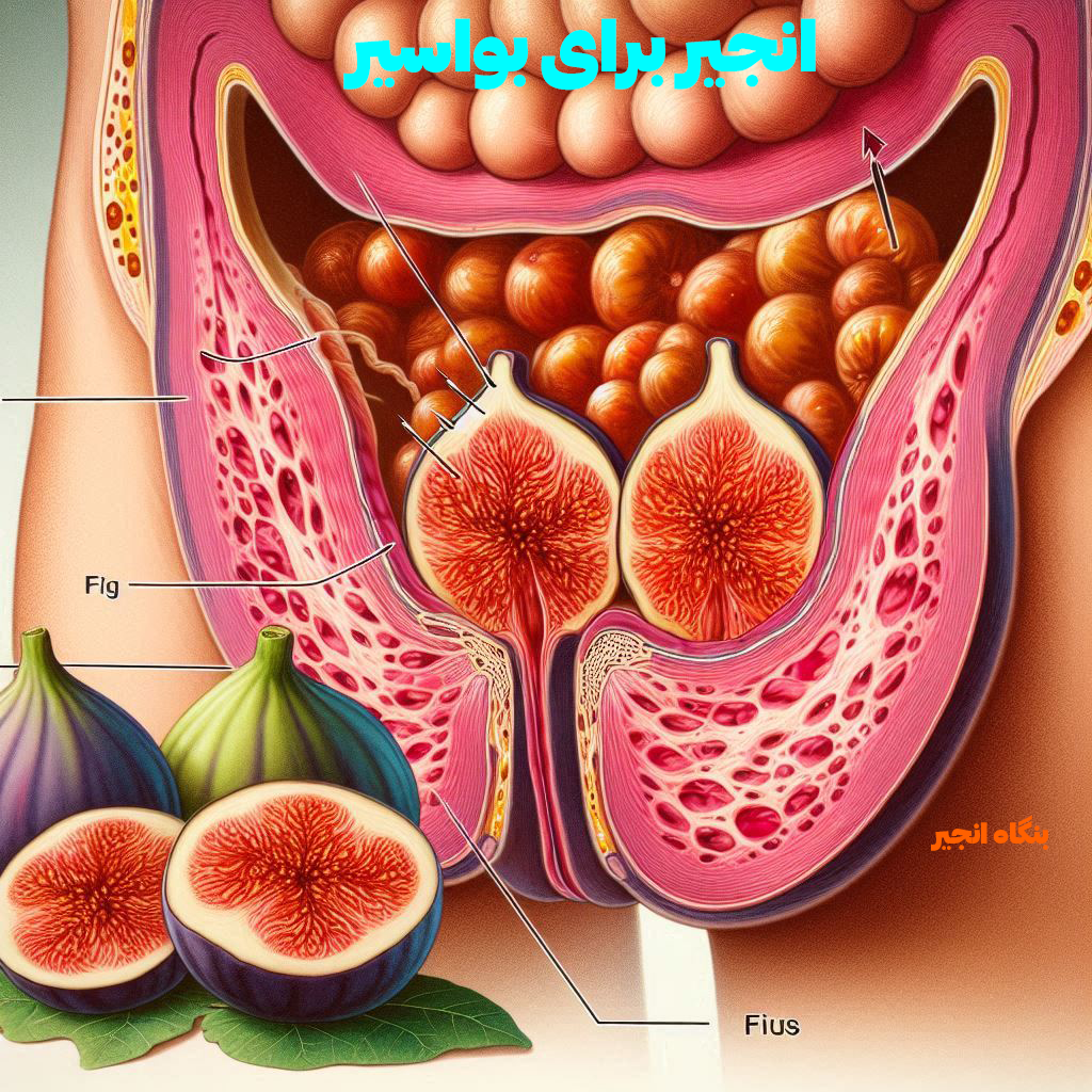 انجیر برای بواسیر انجیر بواسیر